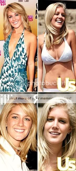 heidi montag before. Heidi Montag. Nuff said